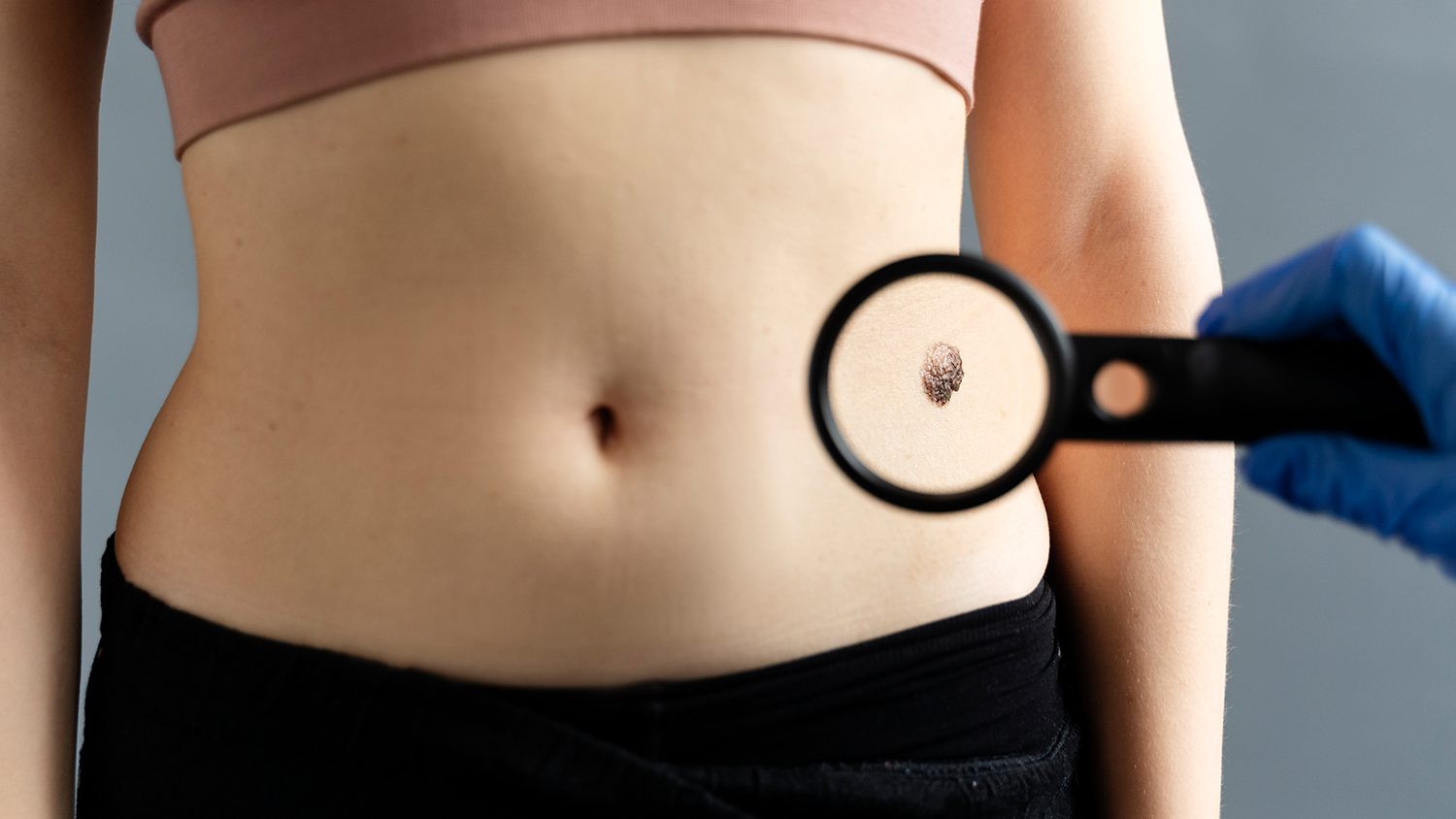 Skin Cancer Removal and Reconstruction