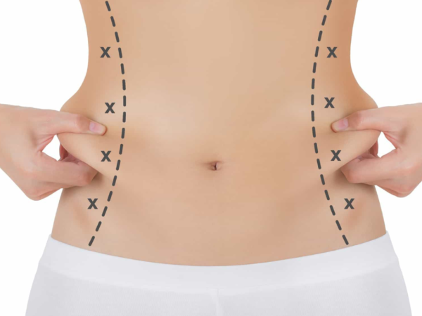 Body Sculpting - The Complete Guide to Body Contouring with Dr. Mutaz Al Shakhanbeh