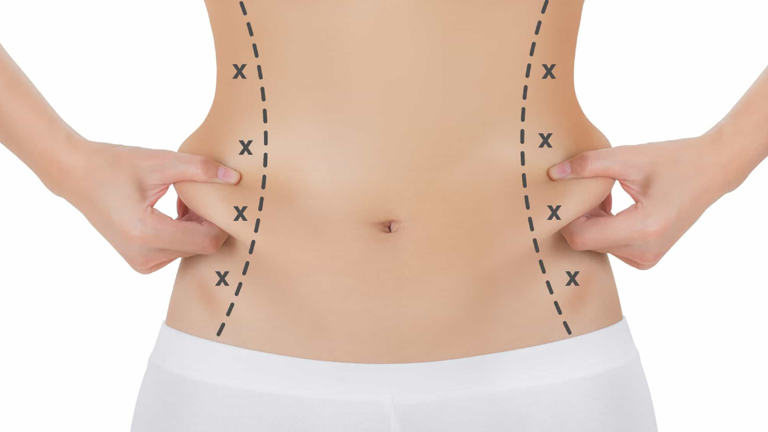Body Sculpting – The Complete Guide to Body Contouring with Dr. Mutaz Al Shakhanbeh