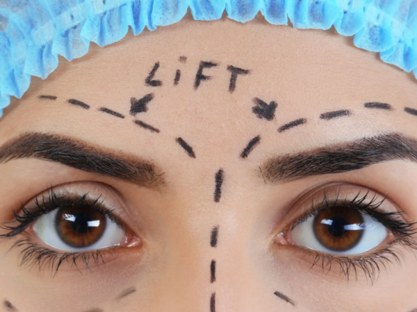 Endoscopic brow lift: The modern technique for forehead tightening with Dr. Mutaz Al Shakhanbeh